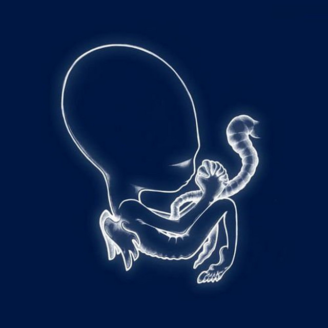 Ágætis byrjun — Sigur Rós, 1999. The breakthrough record for Iceland's most globally significant band. Jónsi's Hopelandic — an invented language with no grammar or stable vocabulary — is the direct conceptual descendant of Elizabeth Fraser's glossolalia, translated into Icelandic post-rock aesthetics.